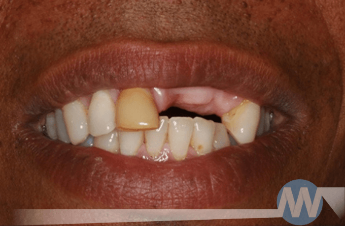Before After Dental 5