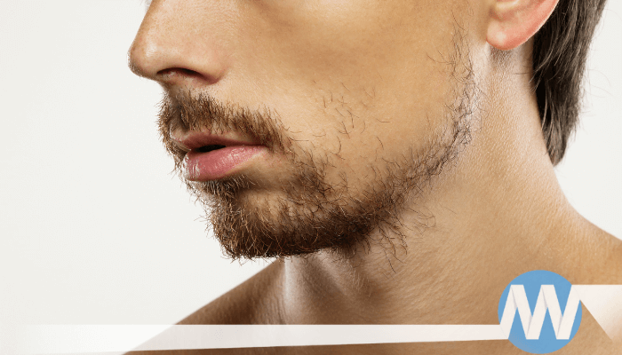 Beard and Mustache Transplant in Turkey